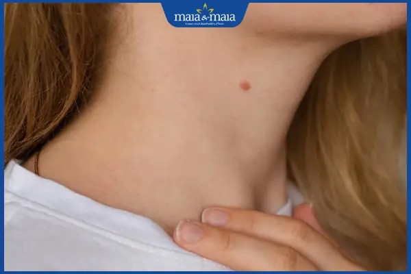 Nốt ruồi ở cằm gần cổ cho thấy trách nhiệm cao.