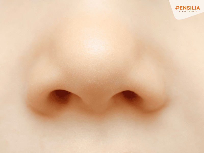 Quý cô sở hữu đầu mũi tròn đầy, da mịn dễ gặp được ý trung nhân như ý, giàu sang